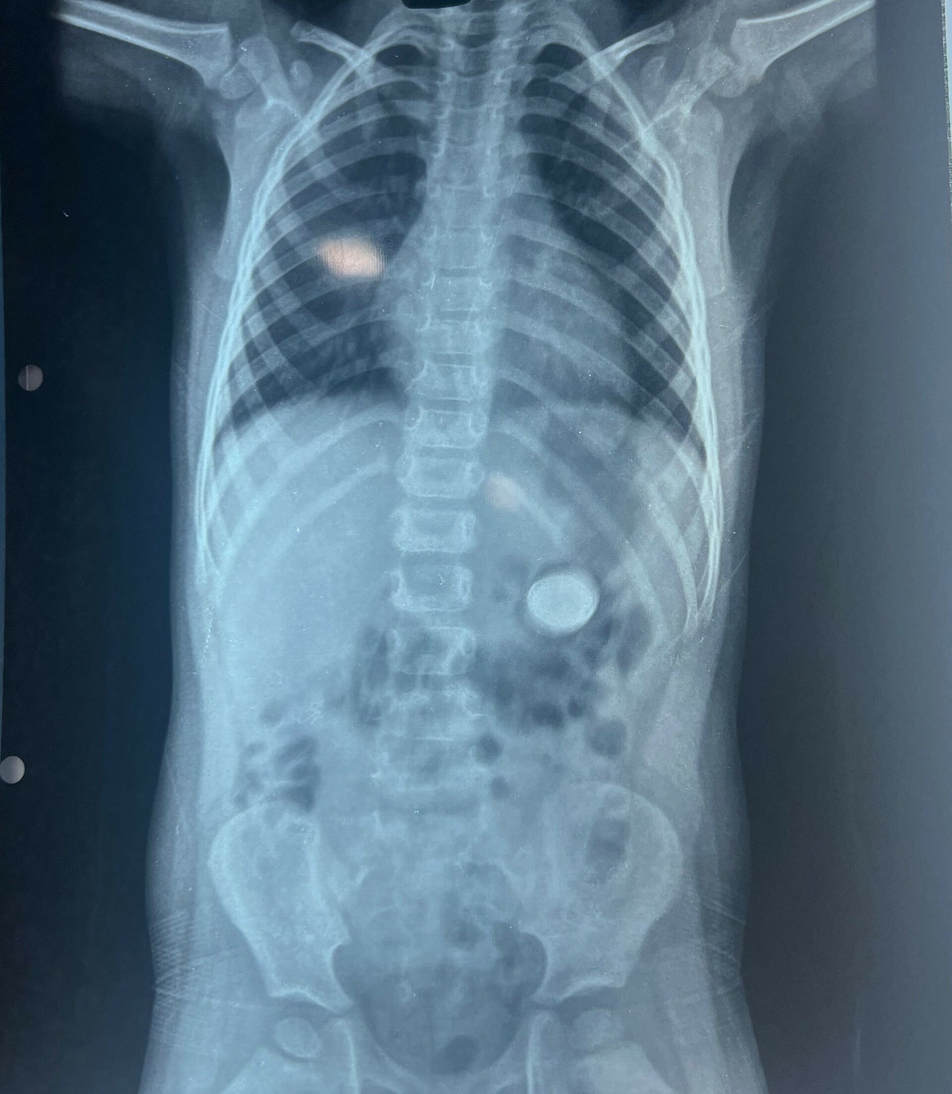 Pulse Multispeciality Hospital|Navale Bridge,Pune