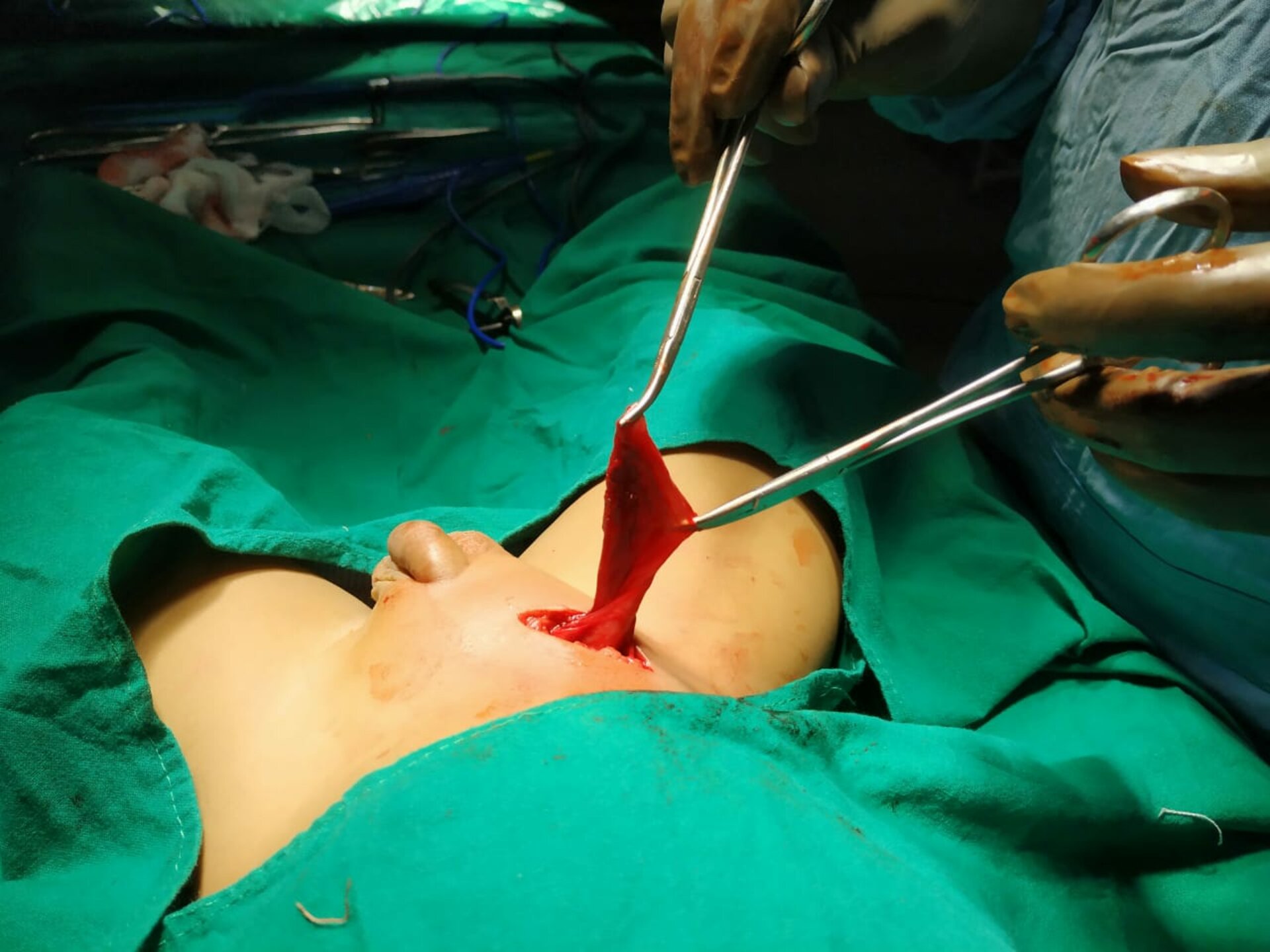 Pulse Multispeciality Hospital|Navale Bridge,Pune